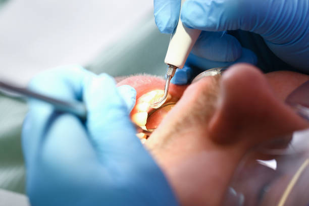 Best Mobile Emergency Dentist in Wayne City, IL